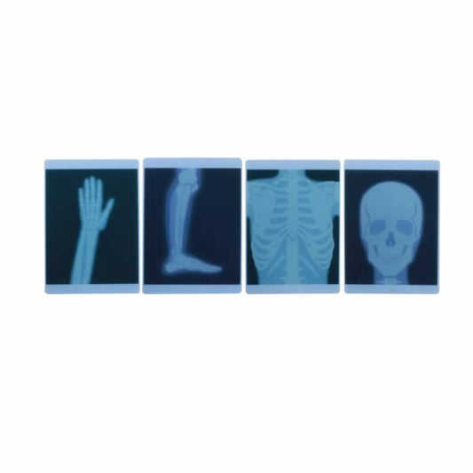 Masterkidz X-Ray Film 4 Piece Set X光片套裝（4張）